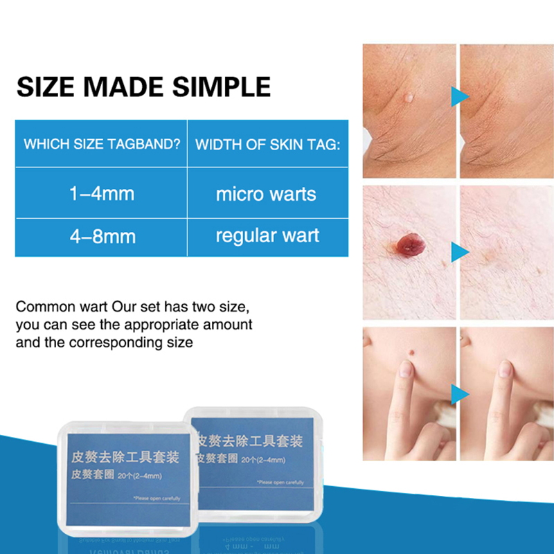 20pcs/Box Flesh Nevus Removal  - огляд і ціна Power Toolbox